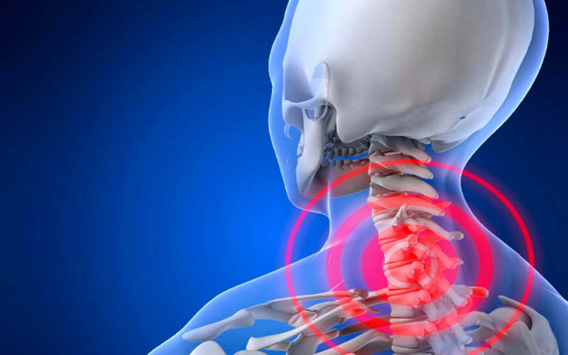 Болі в шийних хребцях сигналізують про те, що в хребетному стовпі є такий запальний процес